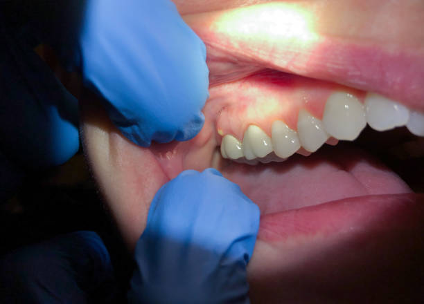 Best Emergency Dentist for Special Needs Patients in Philippi, WV